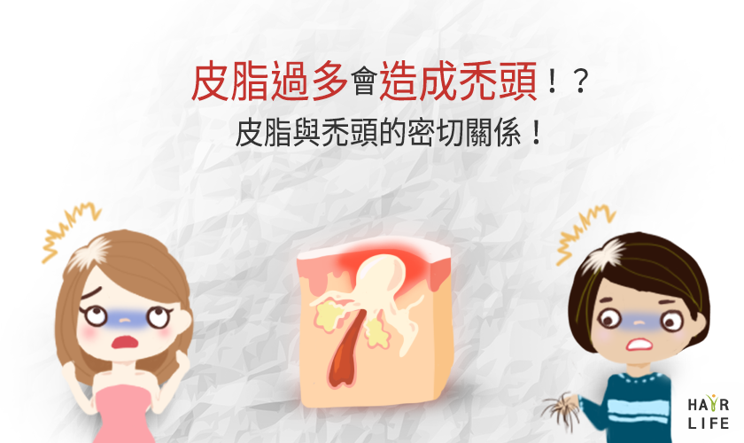 皮脂過多會造成禿頭！？皮脂與禿頭的密切關係！