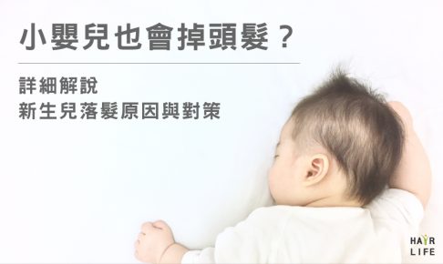 小嬰兒頭髮掉不停該怎麼辦！？新生兒掉髮原因全解析