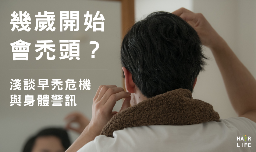 幾歲開始會禿頭？淺談早禿危機與身體警訊