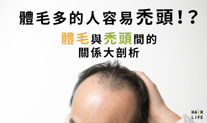 體毛多的人容易禿頭 體毛與禿頭間的關係大剖析 髮樂活hair Life 當自己的頭髮專家
