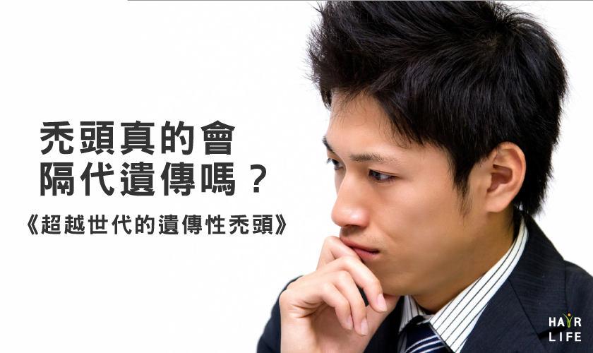 禿頭真的會隔代遺傳嗎?《超越世代的遺傳性禿頭》