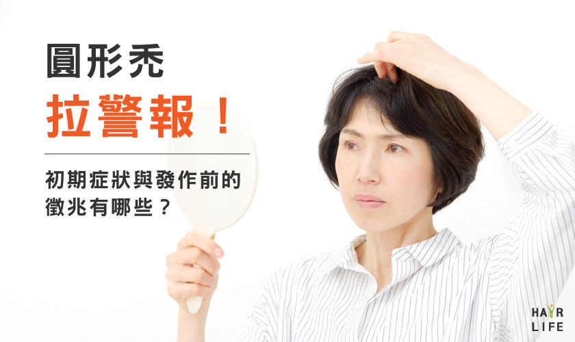 圓形禿拉警報！禿頭的初期症狀與發作前的徵兆有哪些？