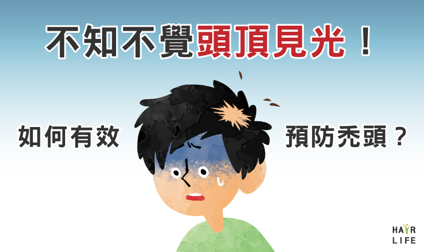 不知不覺頭頂見光！如何有效預防禿頭？