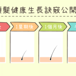 頭皮及頭髮健康生長訣竅