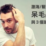 為什麼頭頂會長出「呆毛」？3種改善方式讓頭髮變服貼！