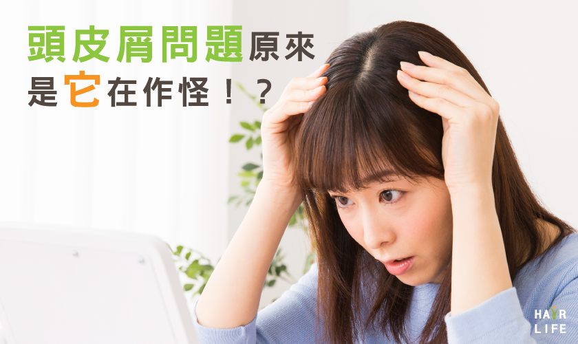 小心頭皮屑是過敏警訊！你的頭皮屑原來是「它」在作怪！？