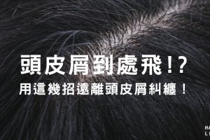 頭皮屑到處飛！？用這幾招遠離頭皮屑糾纏！