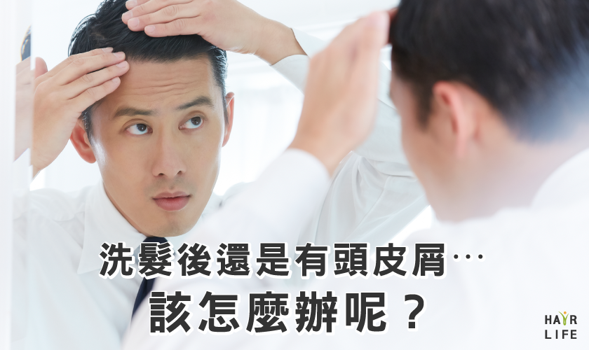 洗髮後頭皮屑還是好多⋯該怎麼辦才好？