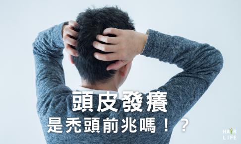 頭皮發癢是禿頭前兆嗎！？淺談兩者之間的關聯性
