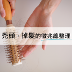 禿頭、掉髮的徵兆總整理【你也有這些困擾嗎？】