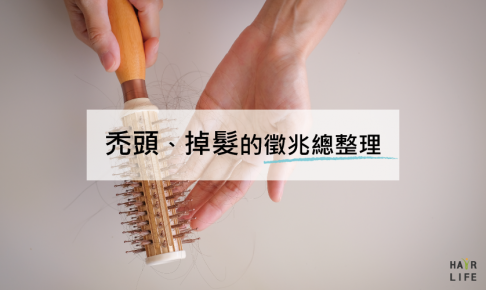 禿頭、掉髮的徵兆總整理【你也有這些困擾嗎？】