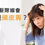 為何髮際線會出現頭皮屑？原因與預防方法大揭密！