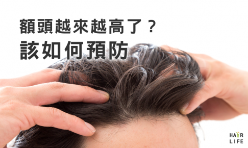 額頭越來越高的原因！？～預防禿頭對策大匯集～