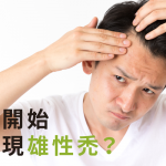 幾歲開始會出現雄性禿