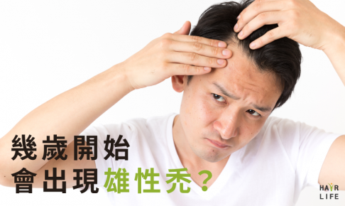 幾歲開始會出現雄性禿