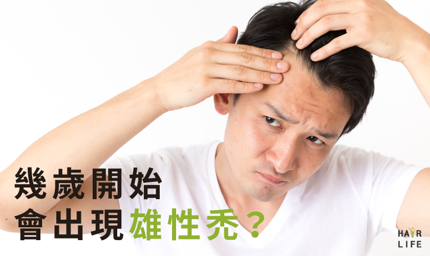 幾歲開始會出現雄性禿