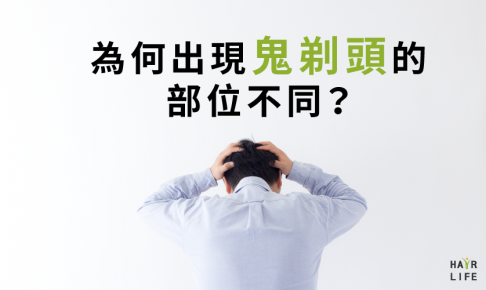 【禿頭五四三】為何每個人出現鬼剃頭的部位不同？