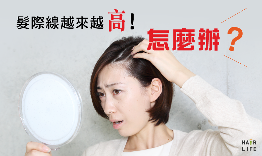 你的瀏海變稀疏了嗎？髮際線越來越高的原因及改善方法大公開！