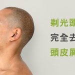 【謠言破解】剃光頭真的能完全去除頭皮屑!?