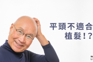 平頭不適合植髮！？究竟植髮條件有哪些？