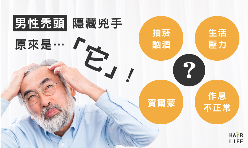 男性禿頭，隱藏兇手原來是「它」！