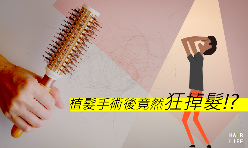 植髮手術後竟然狂掉髮！？難道手術失敗了嗎？