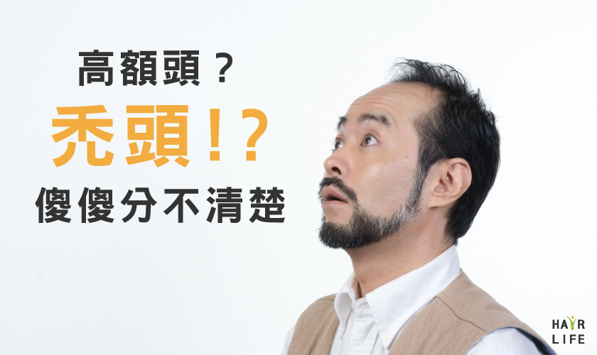 【解惑】高額頭？禿頭？！到底該如何區分
