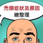 禿頭種類大不同!各種禿頭的症狀及原因總整理