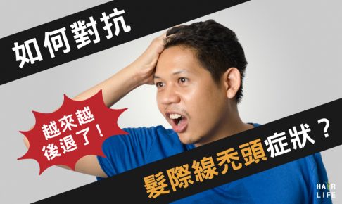 越來越後退了！如何對抗髮際線的禿頭症狀？