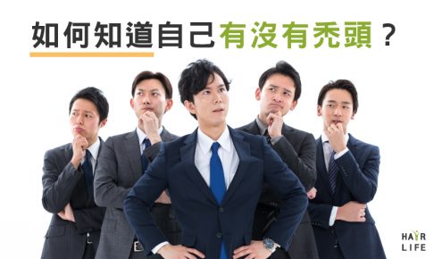 如何知道自己有沒有禿頭？用這幾種方法分辨Ｍ型禿頭！