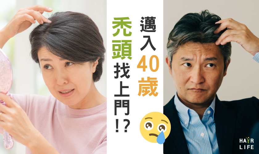 邁入40歲禿頭找上門！？40歲男女禿頭的原因及對策大公開！